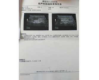 甲状腺结两个疗程调理结果