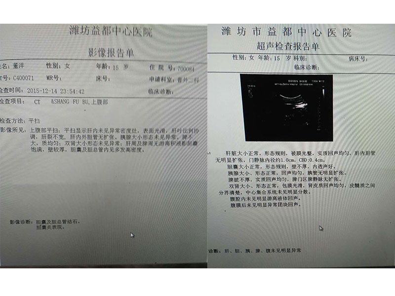 胆囊及胆总管结石，胆襄炎的调理前后对比