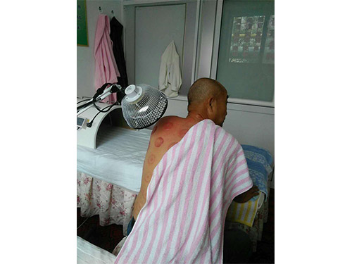 肩周炎颈椎增生患者