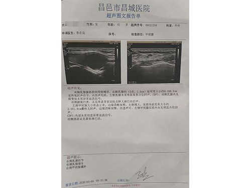 美女三十九岁，于去年四月份检查甲状腺结节